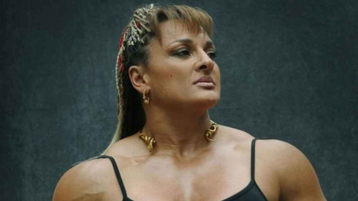 Locomotora Oliveras muestra progreso: signos de respuesta motora después de traqueotomía
