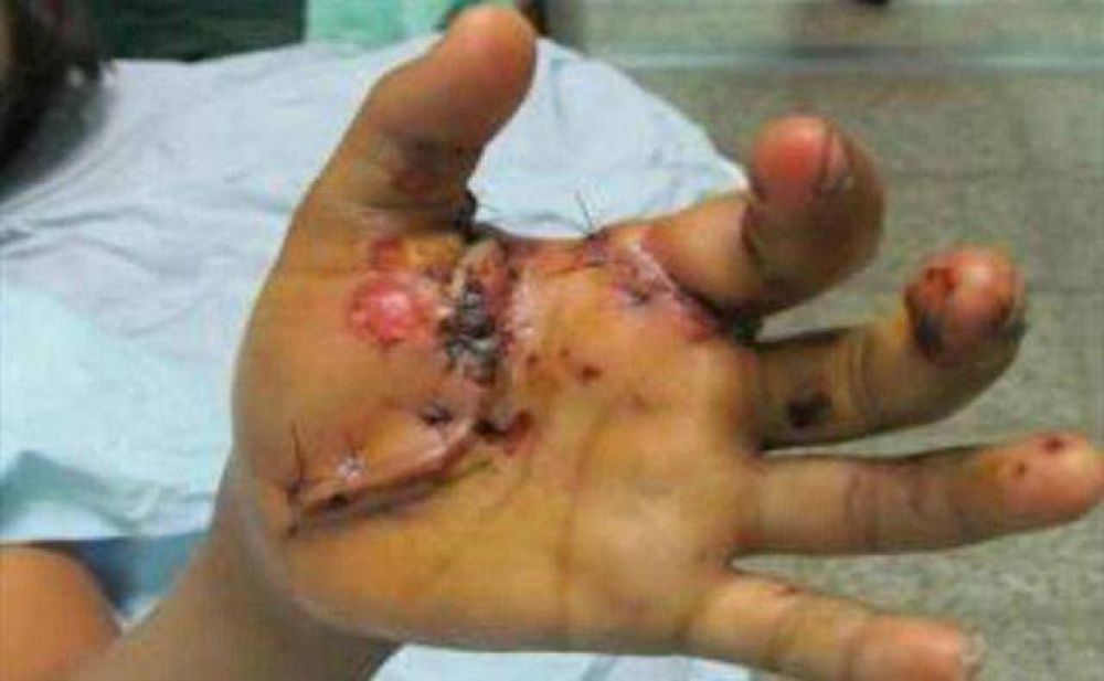 Elevadas multas, más días de arresto para quienes vendan y utilicen pirotecnia en 9 de Julio