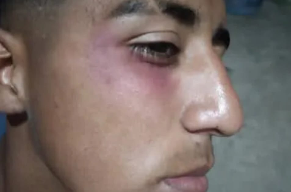 Un jugador fue herido por pirotecnia lanzada desde la tribuna en pleno partido