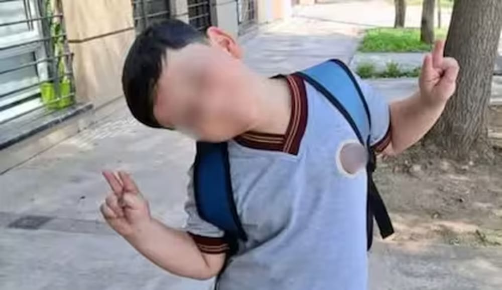 La sonrisa que trajo alivio: Bastián despertó del coma tras su séptima operación