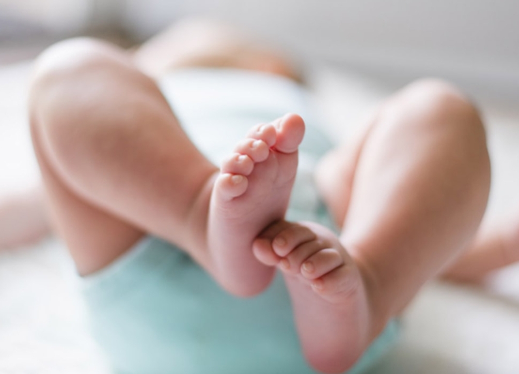 Falleció un bebé con Síndrome de West ¿De que se trata esta patología?