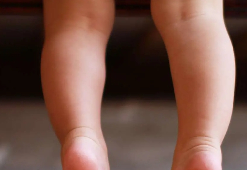 En 9 De Julio: un nene sufrió un grave accidente con un hierro, bomberos asistieron en el caso