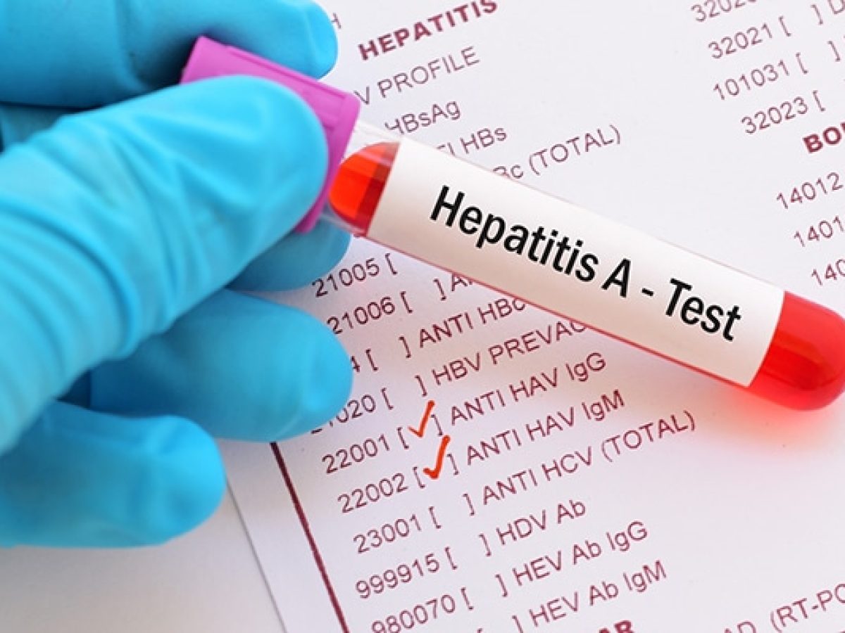 Hospital Rawson realizará una jornada gratuita de testeo de hepatitis virales
