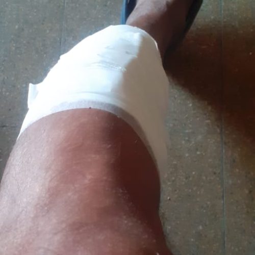 Un perro le destrozo la pierna a un vecino de 9 de Julio (Imágenes Sensibles)