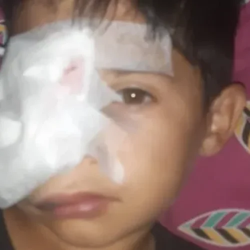 Una madre pide ayuda para costear estudios médicos de su hijo luego de sufrir una  violenta agresión