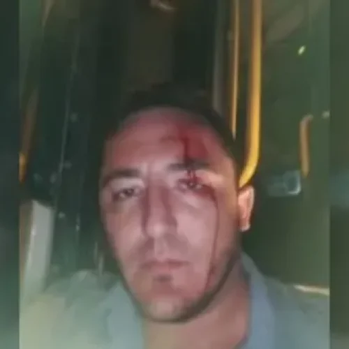 En Rivadavia, atacaron a piedrazos un colectivo y el chofer terminó herido