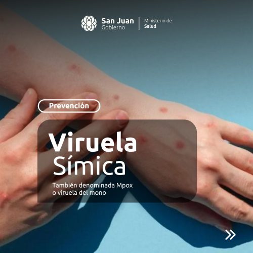 Alerta: posible caso de Viruela Simica