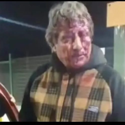 Otra remisero fue brutalmente golpeado, esta vez en Rawson