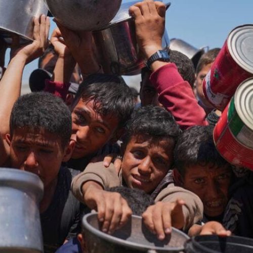 Los niños de Gaza pagan el precio de la guerra y la desnutrición