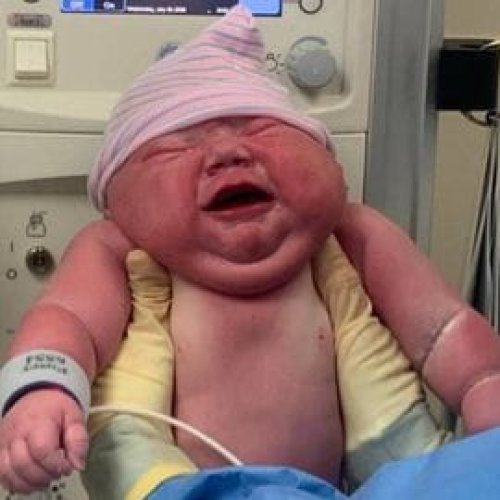 Nació un “súper bebé” y se volvió viral