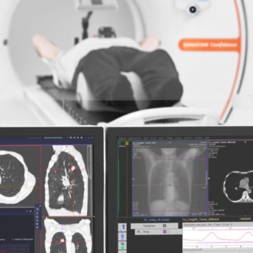 El Hospital Marcial Quiroga lanzó un programa gratuito de detección temprana de cáncer de pulmón