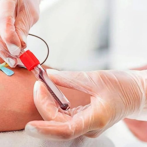 El IPHEM refuerza estrategias ante la baja del 30% en la donación de sangre en San Juan