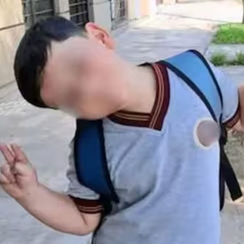 La sonrisa que trajo alivio: Bastián despertó del coma tras su séptima operación