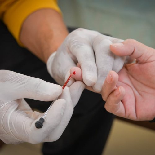 Chagas: San Juan sale a prevenir con información y testeos