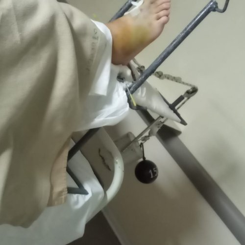 Un padre de Las Chacritas sufrió un accidente y necesita ayuda urgente