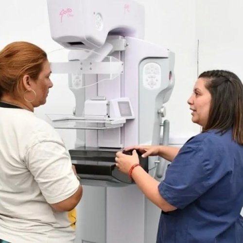 La tarde de las Mamografías:Una jornada gratuita para la salud de las mujeres.