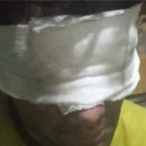 Lo dejó todo frente a las llamas: un bombero terminó con los ojos vendados en Pocito