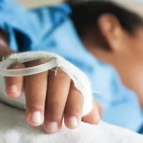 Un niño intentó hacer un cohete casero y sufrió graves quemaduras