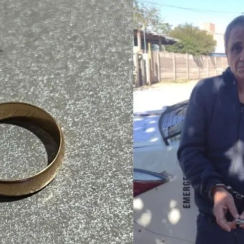 Simuló tener un orzuelo para robar un anillo de oro