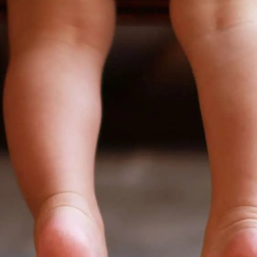 En 9 De Julio: un nene sufrió un grave accidente con un hierro, bomberos asistieron en el caso