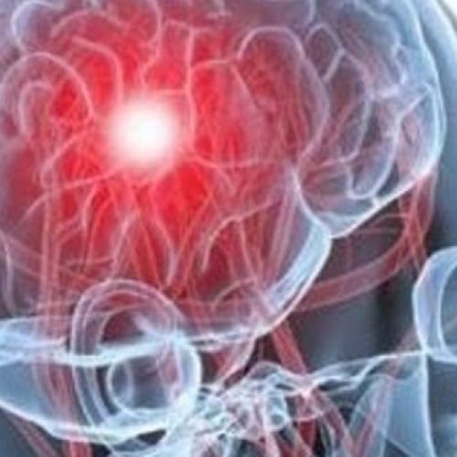 Día Mundial del ACV: el Hospital Rawson realizará una campaña para detectar signos de alerta