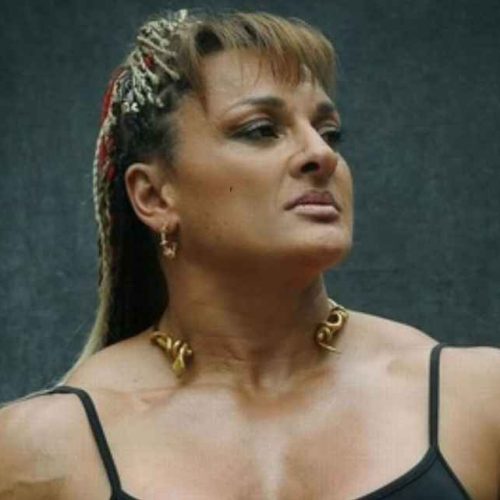 Locomotora Oliveras muestra progreso: signos de respuesta motora después de traqueotomía