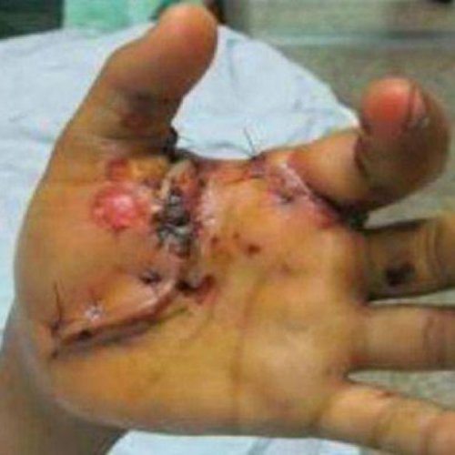 Elevadas multas, más días de arresto para quienes vendan y utilicen pirotecnia en 9 de Julio